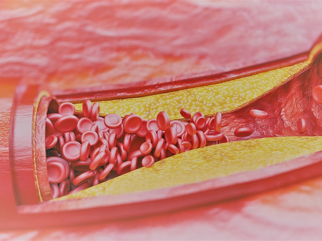 a hipertónia gyógyszeres kezelés nélküli módjai magas vérnyomás cukorbetegben