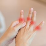 A köszvény tünetei
