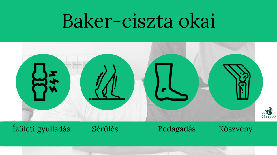 Baker-ciszta 4 oka, 4 tünete, 8 kezelési módja [teljes leírás] - 27 Sellő