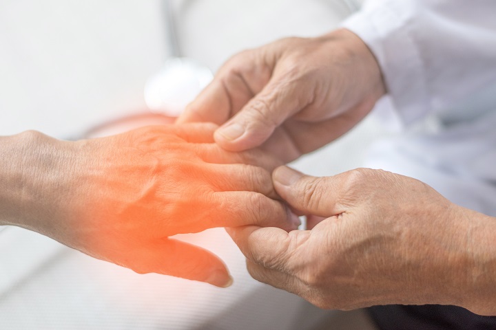 Rheumatoid arthritis ujjak zsibbadása