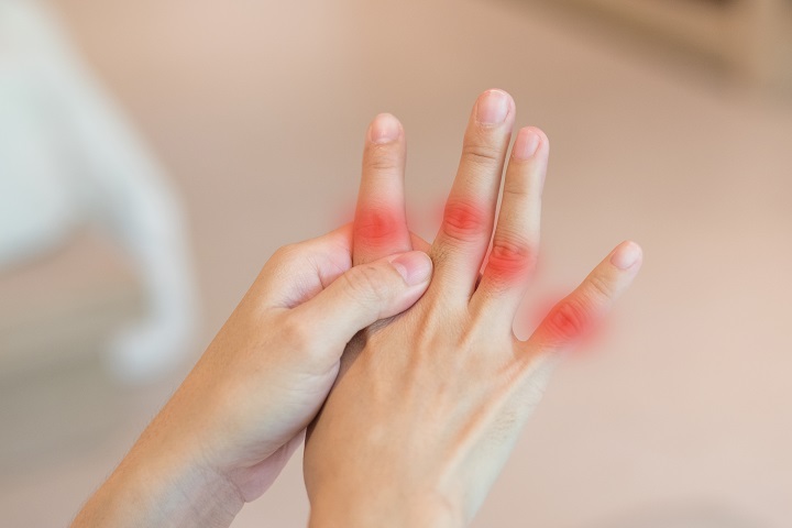 Hüvelykujj köszvényes izületi gyulladása. A reuma és a számítógépes munka is rizikófaktor