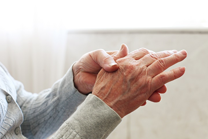a rheumatoid arthritis kezelésének súlyosbodása