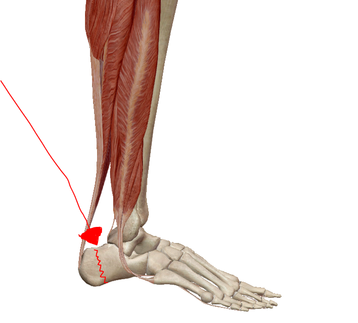 a láb sarkának ízületei fájnak fájdalom és instabilitás a térdízületben